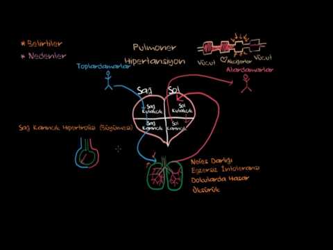 Khan Academy - Pulmoner Hipertansiyon Semptomları ve Nedenleri (Fen Bilimleri) (Sağlık ve Tıp) - 2017.08.07