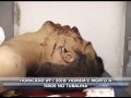 Homicídio 69: rapaz é morto com dois tiros na cabeça.wmv