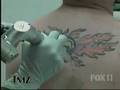 videos de YouTube - Blake Lewis at Dr  TATTOFF