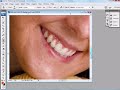 WS Video Tutorial Series: Blemish Retouching Pt1