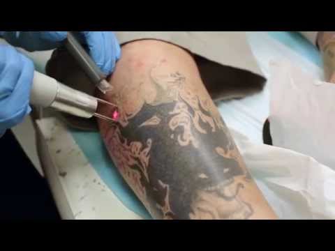 how to cure nightmares