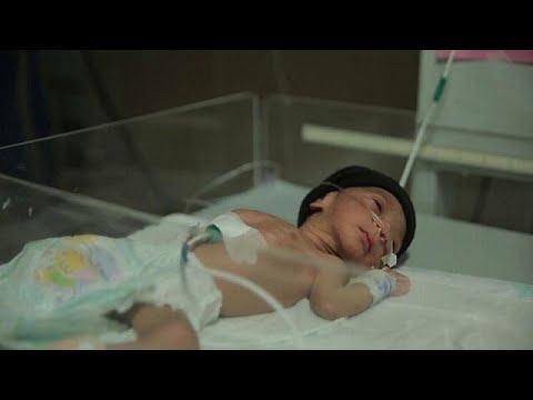 2,6 Millionen Babys sterben im ersten Lebensmonat
