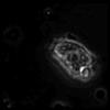 A macrophage sends out pseudopodia to engulf a fungal spore
