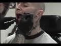 Critter's Lingual frenectomy