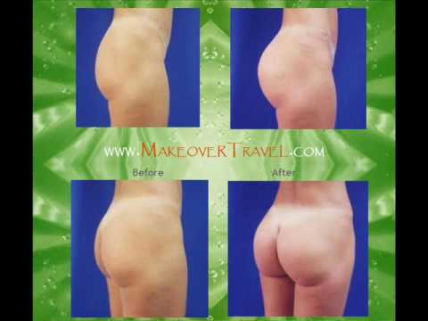 buttock