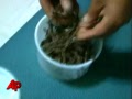 Metal Patient: Nails, Coins Removed From Stomach