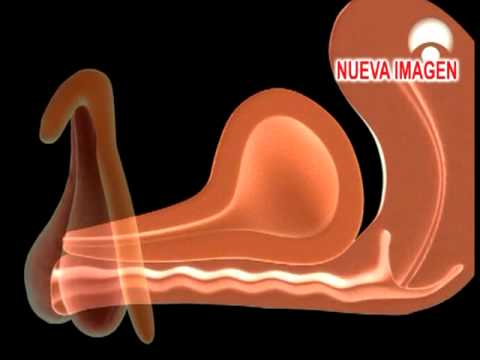 nuevaimagen tvs clitoris