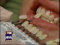 Teeth Whitening on Fox News