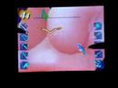 Trauma Center X6: Paraskevi with two styli