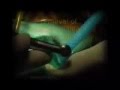 Quecksilber the strange story of dental amalgam