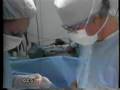 Inflatable Penile Prosthesis Part 1 (AMS 700 CX)