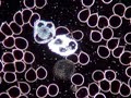 Live Blood Analysis Dark Field Microscopy explained