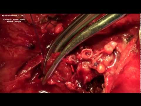 how to isolate epithelial cells