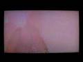 Der W (Stephan Weidner) - Asche zu Asche