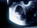 Pukkie Savelkoul zwaait...It's alive!!!