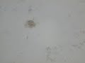 CHEMTRAILS SEWAGE EATING ROTIFERS OF THE AEROSOLS CHEMTRAILS SEWAGE EATING ROTIFERS OF THE AEROSOLS