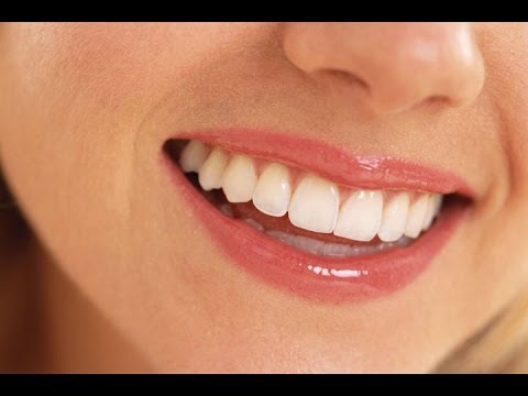how to whiten amalgam fillings