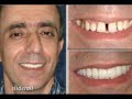 Smile Photo Gallery Smile Photo Gallery