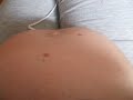 bump