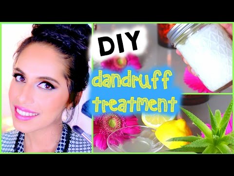 how to relieve dandruff itch