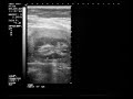 mi bebe a los tres meses de gestacion mi bebe a los tres meses de gestacion