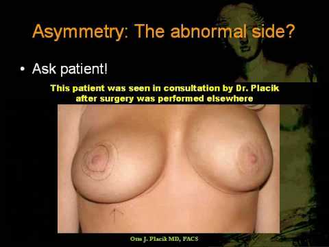 puffy breast