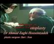 otoplasty