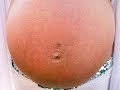 Pregnancy Piercings (and Other Bad Ideas!) Pregnancy Piercings (and Other Bad Ideas!)