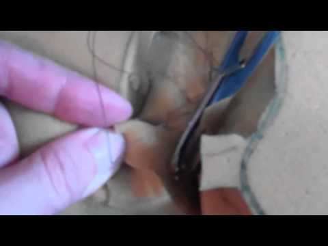 how to perform episiotomy suturing