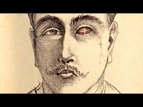 how to transplant eyes