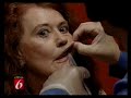 Radiesse Florida - Dr. Roger Bassin - Wrinkle Filler