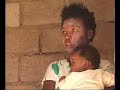 Part 10 - Girl with AIDS and shingles Part 10 - Girl with AIDS and shingles