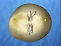 MEIOSIS