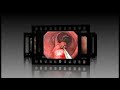 Endoscopic Presentation