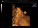 Baby 4D