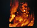 Ultrasound Video+3D - The Miracle of Life Ultrasound Video+3D - The Miracle of Life