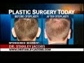 The Best of Dr. Stanley Jacobs: Ear Job