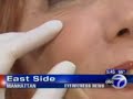 New York Plastic Surgeon Dr. Halaas on Non-surgical Facelift