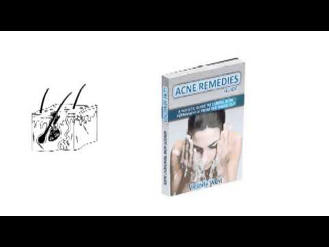 how to get rid of t zone acne