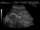 conner michael lee cheever conner michael lee cheever
