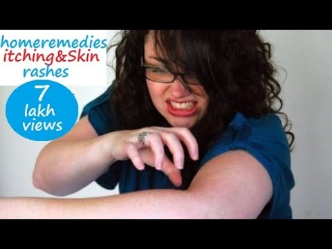 how to cure skin allergy naturally