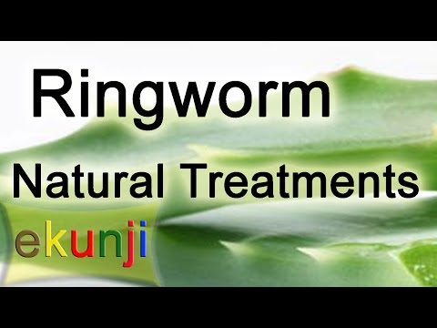 how to treat fungal skin infection