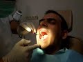 �ukulats  dad  at the dentist- �a?an di?�ide