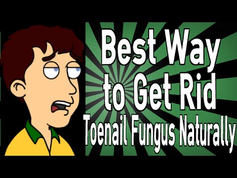 how to kill fungus naturally