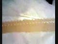 Miami Colonics Irrigation/Hydrotherapy: FeelTheHeal.Com Miami Colonics Irrigation/Hydrotherapy: FeelTheHeal.Com