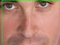 Portrait Makeover Part  2 - Removing Pimples & Wrinkles