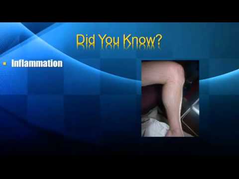 how to cure twisted knee