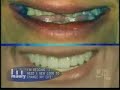 Dr. Jantz on Maury Povich discussing eating disorders Dr. Jantz on Maury Povich discussing eating disorders