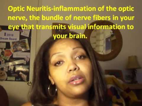 Optic Neuritis with Multiple Sclerosis