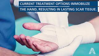 ReHeal Glove